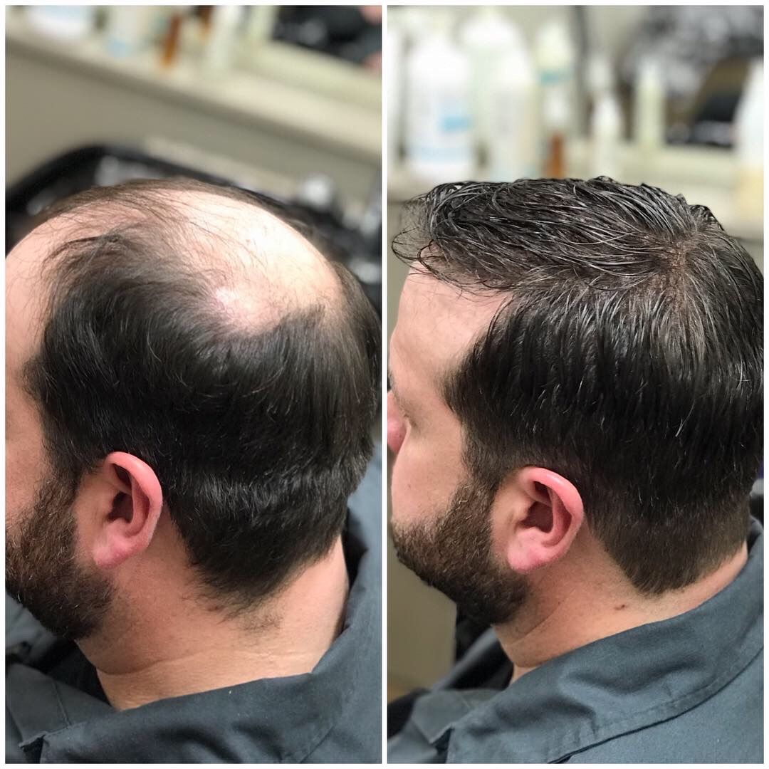 Hair Growth Oil 3.0: The Revolutionary Solution For Modern Hair Loss
